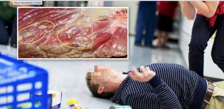 18 anni carne cruda muore convulsioni