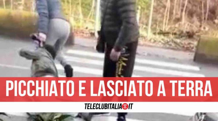 aggressione brusciano picchiato uomo