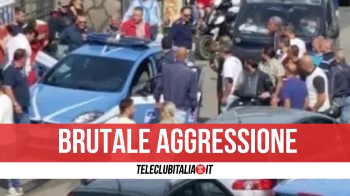 perde occhio aggressione giugliano