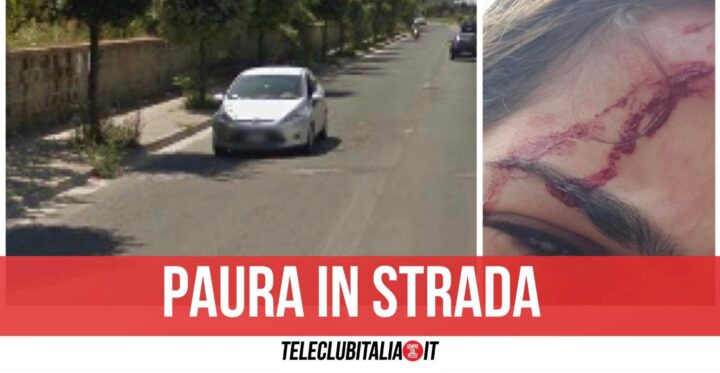 villaricca testata ragazza aggredita via campana