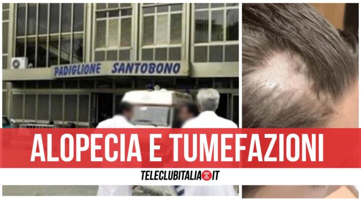 santobono napoli ragazzina senza capelli