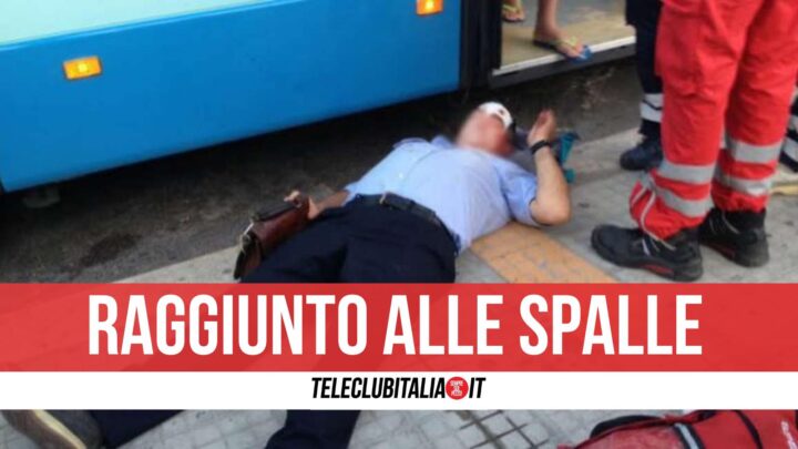 autista anm aggredito trauma facciale napoli