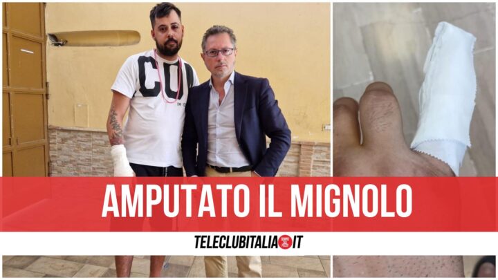 Enrico Pestato Parcheggiatore Abusivo Mignolo Amputato