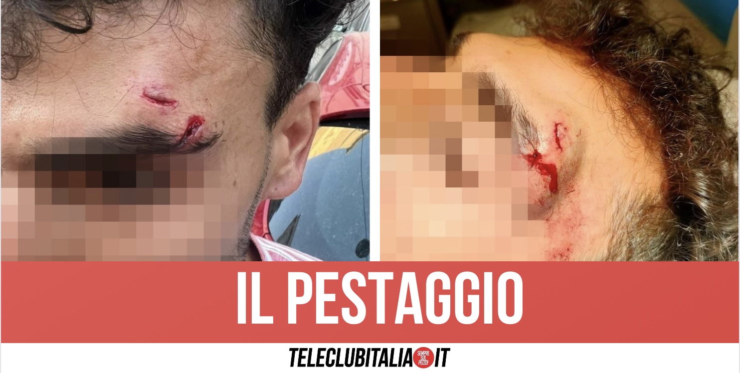 Pestato Dopo Incidente Napoli