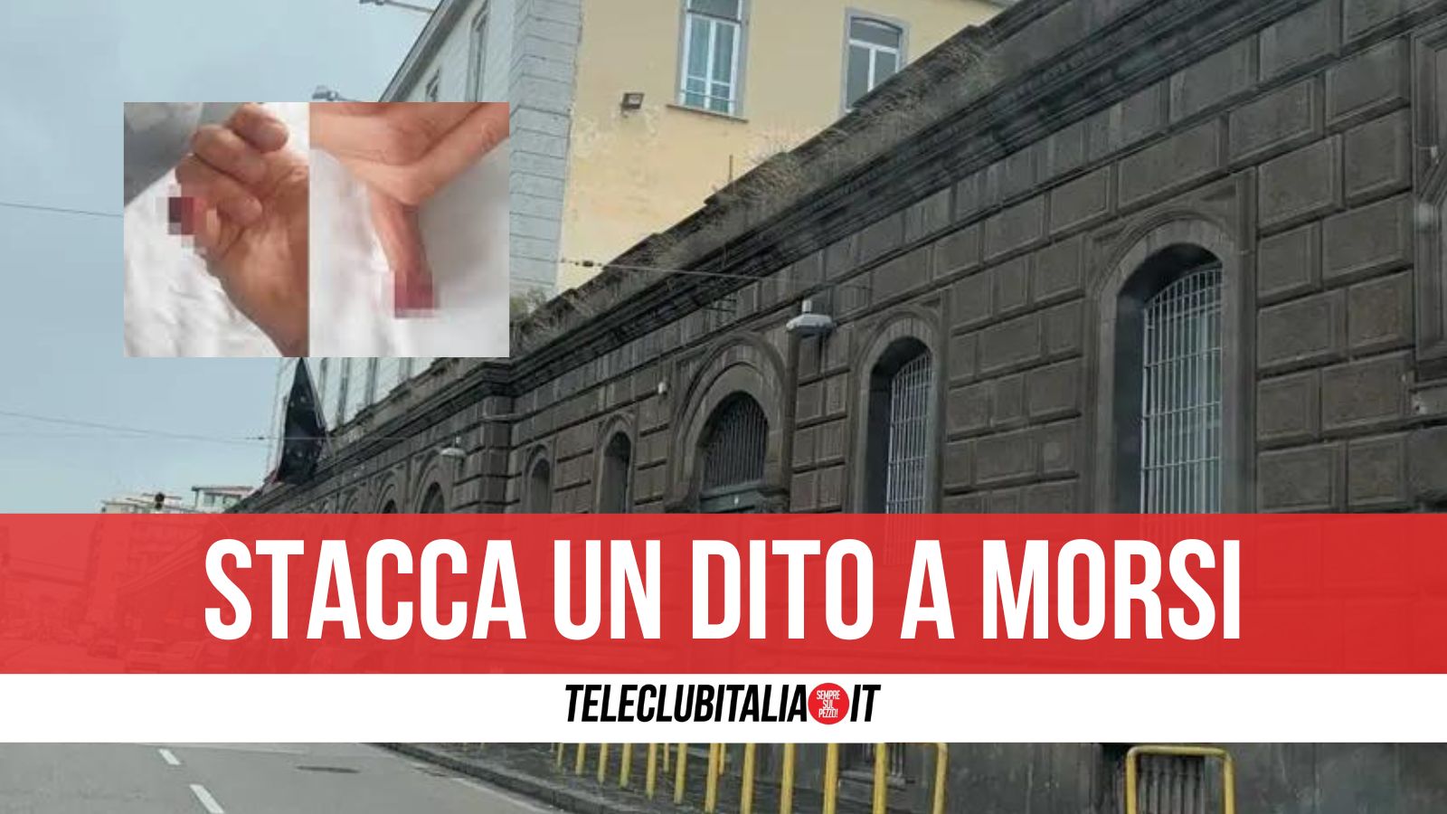 Cannibalismo in carcere a Napoli: detenuto mangia dito al compagno di cella