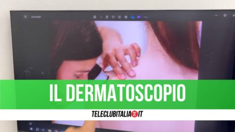 Dermatoscopio